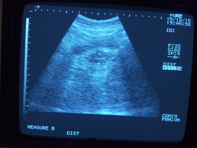 アップロードファイル 91KB